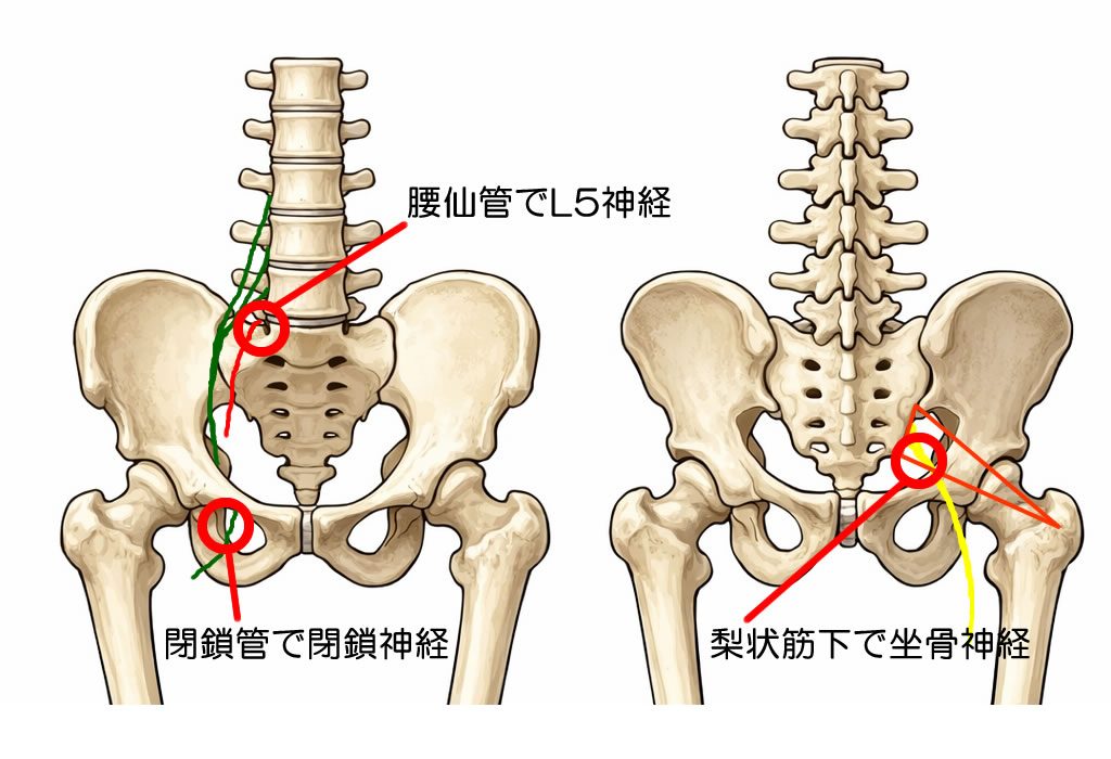骨盤にある神経絞扼ポイント